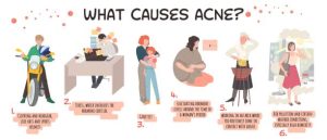 period acne