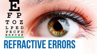 refractive error featured image